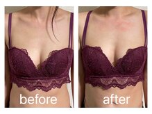 ハートランド(HEARTLAND)/クレオパトラコース☆1回の施術