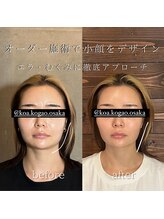 コア 心斎橋 堀江店(koa)/お客様ビフォーアフター