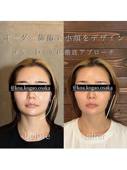 コア 心斎橋 堀江店(koa)/お客様ビフォーアフター