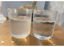 ステッラ(STELLA☆)/毛穴洗浄　Before/After