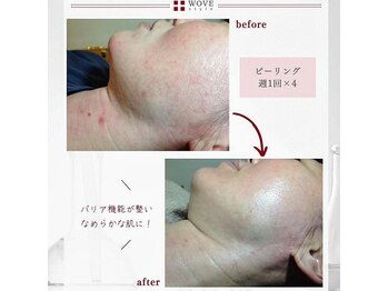 サロンドゥレーヴシエル(Salon de reve Ciel...)/【WOVEstyle】トリートメント