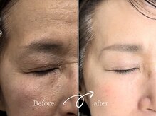 レディゴー(LADY GO)/上品な華メイク