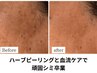 【シミケア・美白】長年のシミケアも間に合う！広範囲で手が出せない方へ