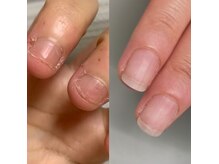 ネイルレリア(nail relia)の雰囲気（深爪育成）