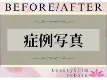 ビューティースリム リボーン 吉祥寺店(reborn)/【改善症例写真】