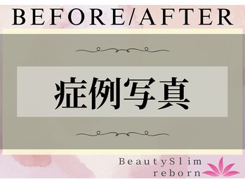 ビューティースリム リボーン 吉祥寺店(reborn)/【改善症例写真】