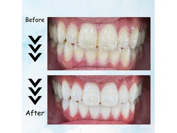 エクシアホワイトニング 塩釜口駅前店