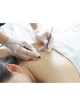 デリケート部分の脱毛/Vライン/VIO