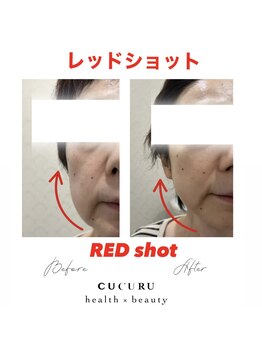 ククルヘルスビューティー(CUCURU health×beauty)/たるみ輪郭形成レッドショット
