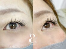 ムニ(muni)/&healthy【アンドヘルシー】