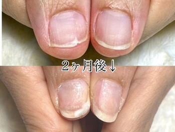 グレースレディ 大阪店/(深爪/長さだし/フィルイン)