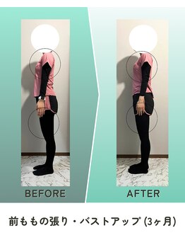 縁/ビフォーアフター