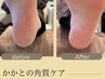 【FOOT◇ケア】足の角質除去ケア□夏に向けて綺麗なかかとに！¥5500→