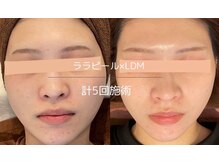 ライフ美容整体院 恵比寿(Life美容整体院)/ララピール×LDM