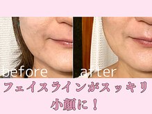 ララスマイル 鶴崎森町店の雰囲気（たるみ改善！小顔になれる♪ 森町 皆春 明野 猪野 &nbsp;整体 頭痛）