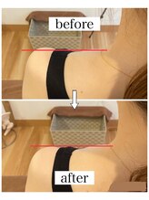 ナチュール(Nature)/巻き肩ビフォーアフター