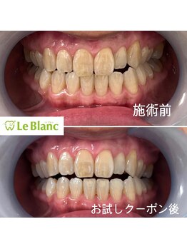 ルブラン 奈良店(Le Blanc)/通い放題スタート！