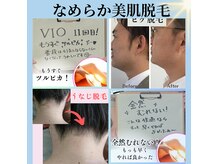 フレサ(Fresa)の雰囲気（【女性】顔、全身脱毛【男性】ヒゲ★仕上がりにこだわり脱毛）