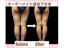 スワン 新栄店(SWAN)/下半身痩せに特化【スリム美脚】