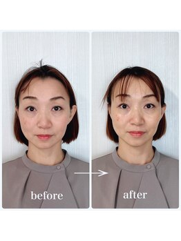 ラリマール/お客様ビフォーアフター