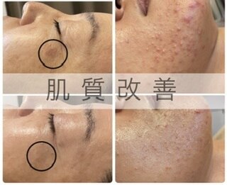 肌質改善エステサロン♡ Replu肌質改善とアロママッサージ専門店 | 諏訪市エステサロン