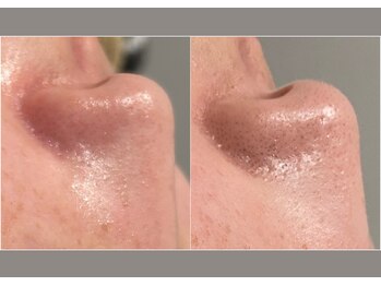 コア チャーム(CORE CHARM)/継続、維持！