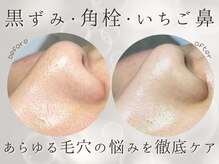 ニーズ(NIEES)の雰囲気（毛穴の開き&汚れには毛穴洗浄がマスト◎）