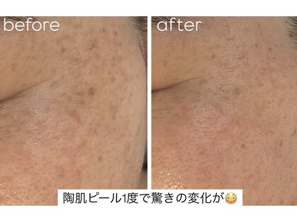 ポエマ(POEMA)の写真