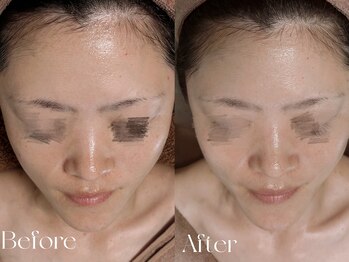 ウィハナ(wehana)/【セラピール】はり/つや