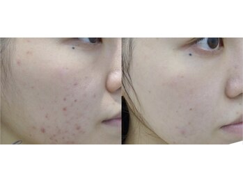 スリリアン 銀座/★お客さまビフォーアフター★