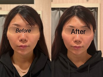 薬手名家 心斎橋店/お客様ビフォーアフター