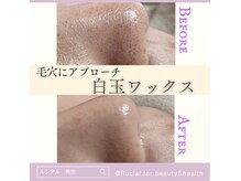 ルシアル(Rucial)の雰囲気（毛穴の大掃除に最適♪明石エリアで少数のフェイシャルワックス♪）