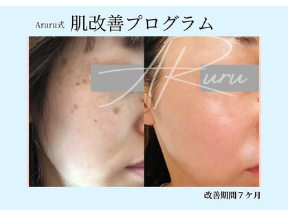 アルルプラス 山科(ARuru+)の写真