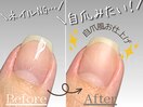 自爪育成・深爪改善コース
