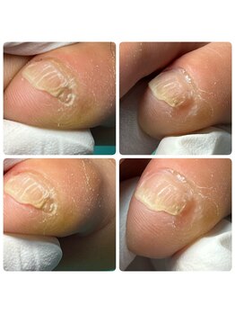 巻き爪補正店 町田店/