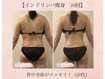 オキシー グレイス 小倉店(OXY Grace)/20代お客様ビフォーアフター