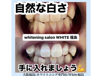 ホワイトニングサロン ホワイト(WHITE)/セルフホワイトニング/大阪/福島