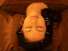 ジネコラボ 町田(Gyneco-labo)/充実のオプションメニュー