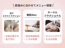 ベクティール(BEQUETHEL)