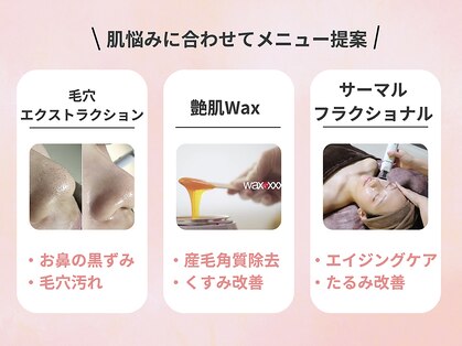 ベクティール(BEQUETHEL)の写真