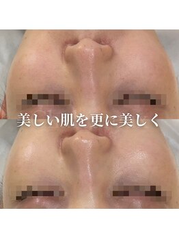 サロン ド ボーテ シャルル(Chaleureux)/更に突き詰めたい美肌づくりに