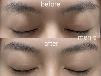 シエナ アイ(CIENA eye)/