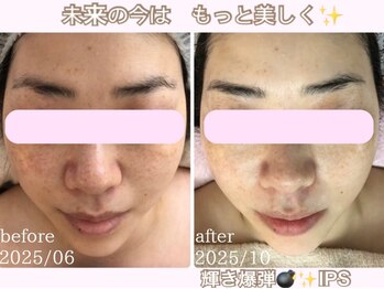 アルページュ(Arpege)/秋美肌★水滴フル管理LDM