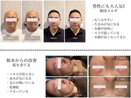 カンコルギセラピー 広島幟町店(KAN)の写真