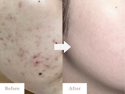 ベル 戸塚(Belle)の写真