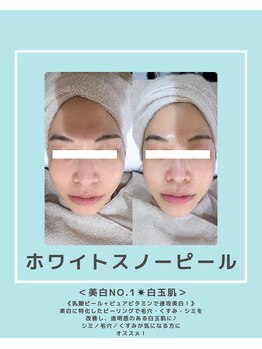 ソワナ(soina)/【神楽坂駅/フェイシャル/毛穴】