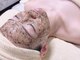 アルモニー(armonie)の写真/毛穴/ニキビケア/肌質改善/エイジングケアに◎今話題の【ゼルクアハーブピーリング+筋膜リフトUP¥16500】