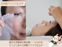 ソワン/フェイシャル/毛穴/小顔/シミ