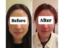 マンマ ジュンナ/【浜松/小顔/小顔矯正】