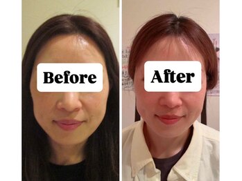 マンマ ジュンナ/【浜松/小顔/小顔矯正】